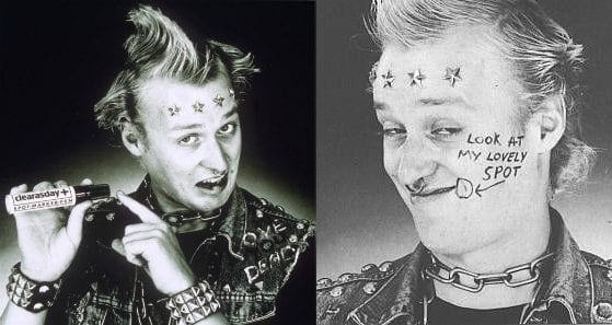 Vyvyan from The Young Ones draws a circle in marker pen around a spot on his face
