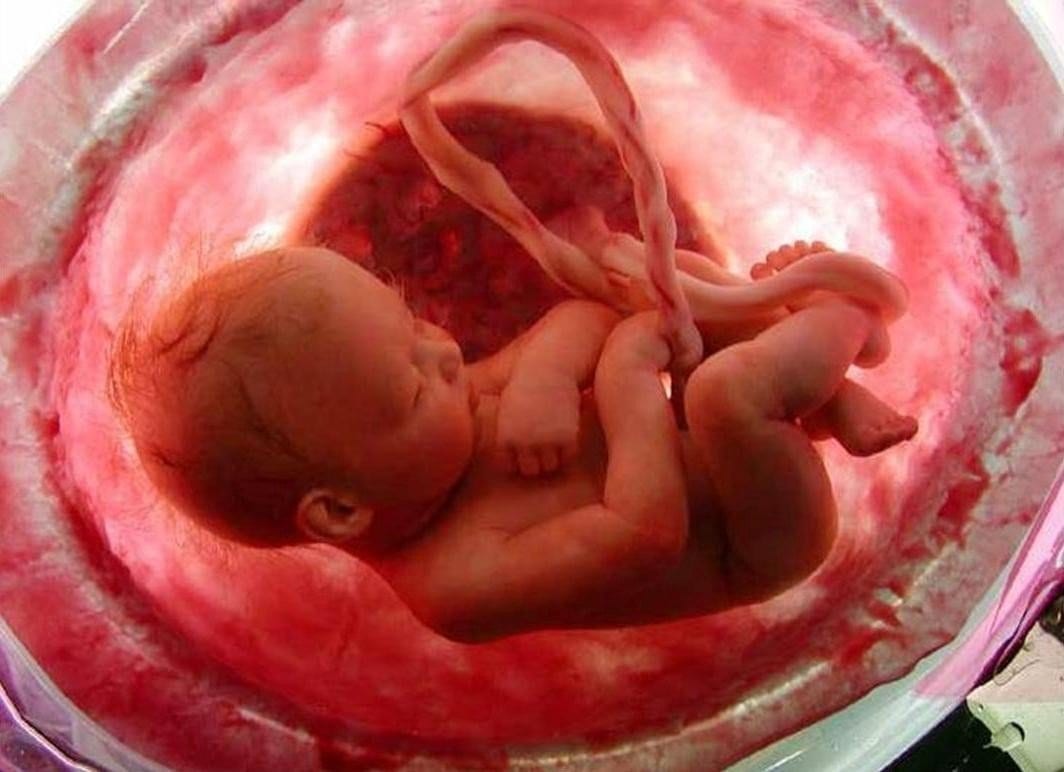 a baby inside the placenta 