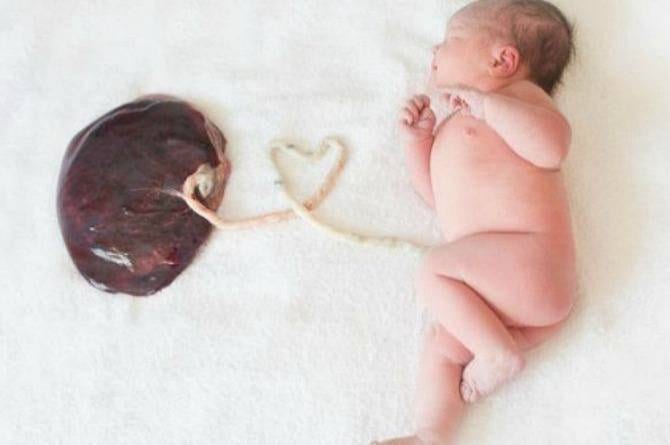 a baby attached to its placenta
