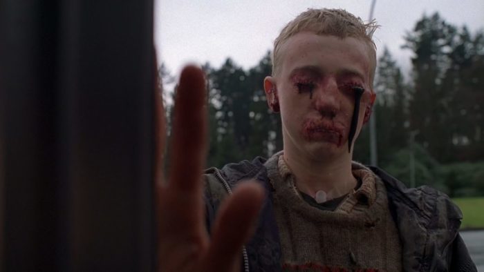 A boy presses his hand against a window. He has scabs over his eyes and mouth, and black oil is leaking from his eyelids