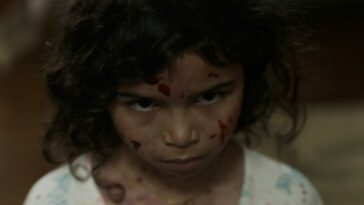 A child stands with their head tilted, and a grimace on their blood spattered face.