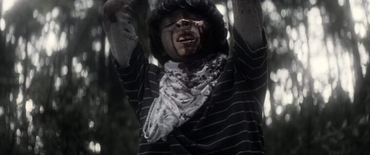A young boy with a bloody face holds his hands over his head