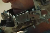 A metalic device is attached to the face of an unknown person.