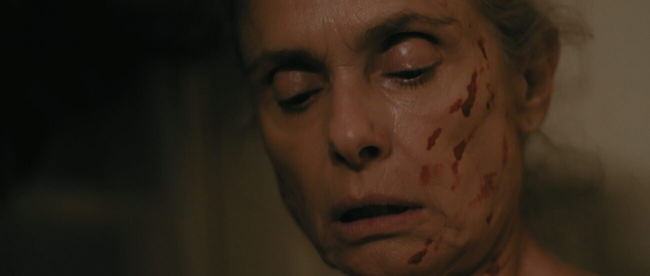 A close-up shot of a woman with scratches on her cheek