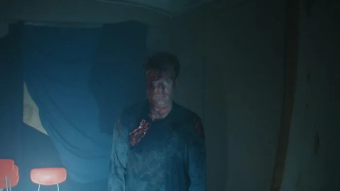 A man with bloodied scarring on the right side of his face is seen under a harsh flashlight.