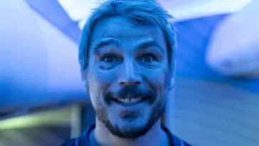 A bleach blonde man with a black eye is seen smiling directly into the camera under an ambient blue light.