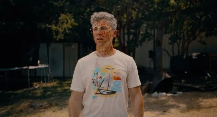 A man with multiple bug bites stands on a beach
