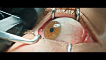 An eye is held open by surgical devices, as a needle is prepared to be inserted.