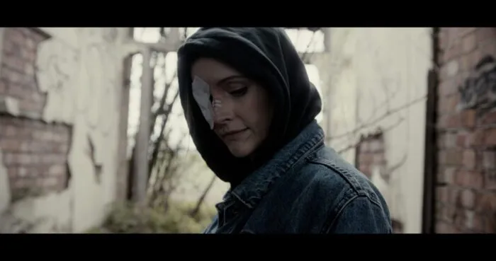 A woman with a sweatshirt hoodie over her head and a bandage over her right eye cracks a slight smile.